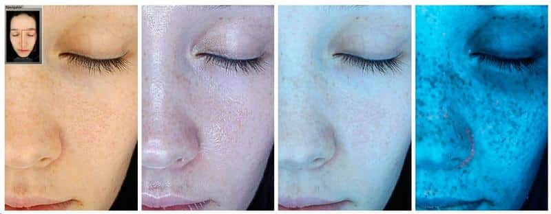 Glimpse Skin Analysis Glimpse Skin Analysis Naples