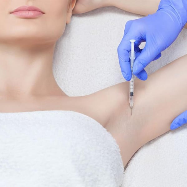 a woman getting hyperhidrosis treatment under her arms with rf microneedling in fort myers and naples, fl