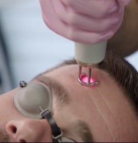 refresh refresh chrome laster skin treatment in fort myers and naples, fl
