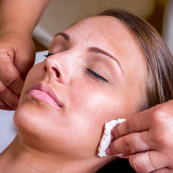 tca-peels a woman getting a tca peel in fort myers and naples, fl