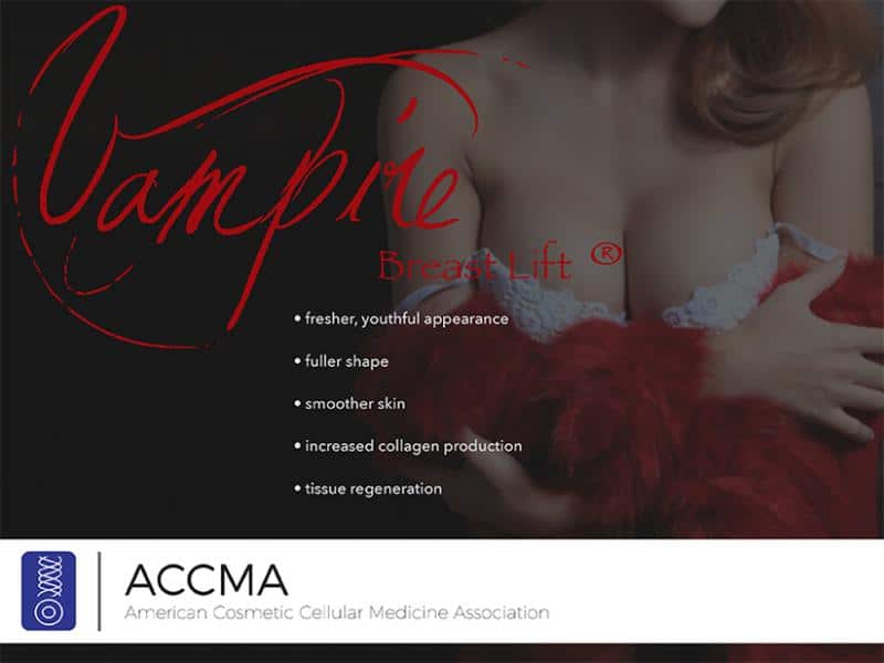 vampire-breastlift-fort-myers-naples vampire breast lift in fort myers and naples fl
